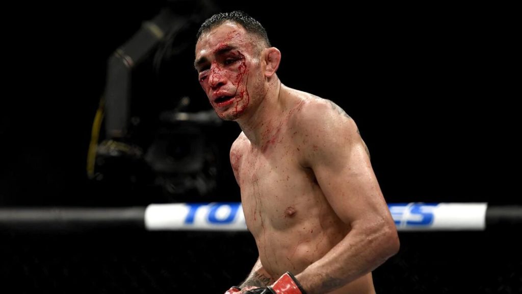 tony ferguson UFC