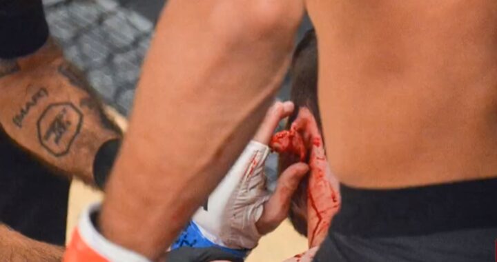 terrible lesión en MMA