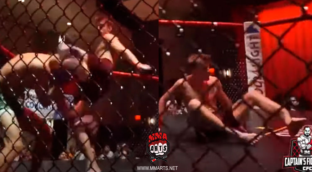 PATEA-LA-CABEZA-Y-SE-ROMPE-LA-PIERNA