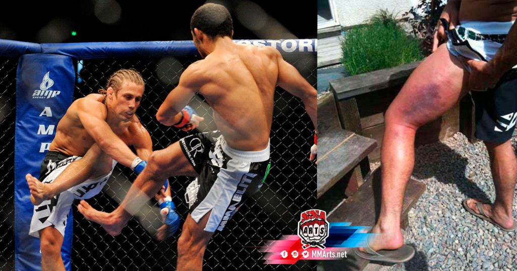 jose-aldo-le-destuye-la-piernas-a-faber-ufc