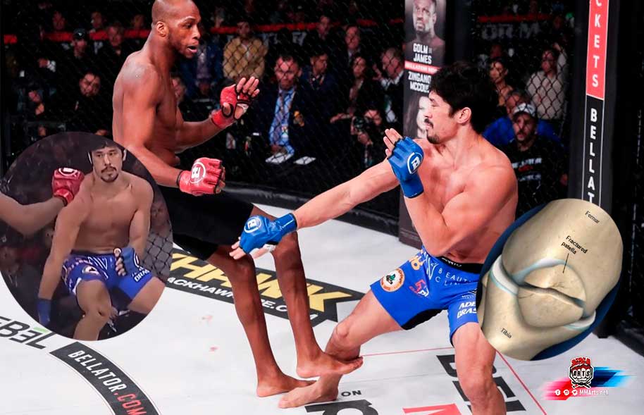 patada-michael-venom-page-MVP-a-Gaoti-Yamauchi-bellator-292--terrible-lesión