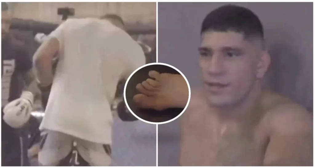 alex pereira se rompre el dedo ufc 300